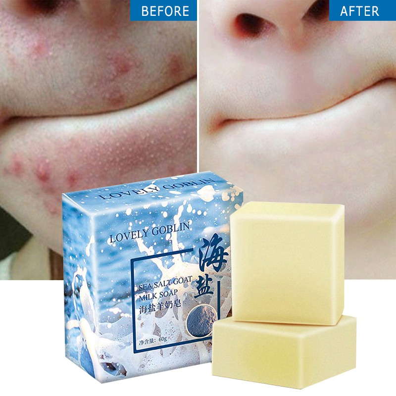 [fast] Lovely goblin sea salt mite removal makeup oil control sulfur face wash goat milk soap 【ou】