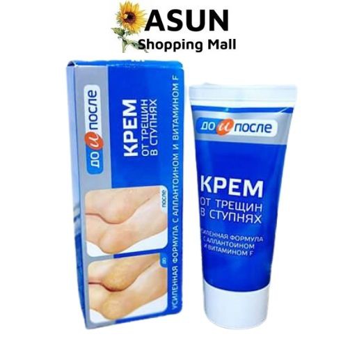 Kem Ngăn Ngừa Và Hồi Phục Nứt Nẻ Gót Chân Kpem Chính Hãng Nga 50ml