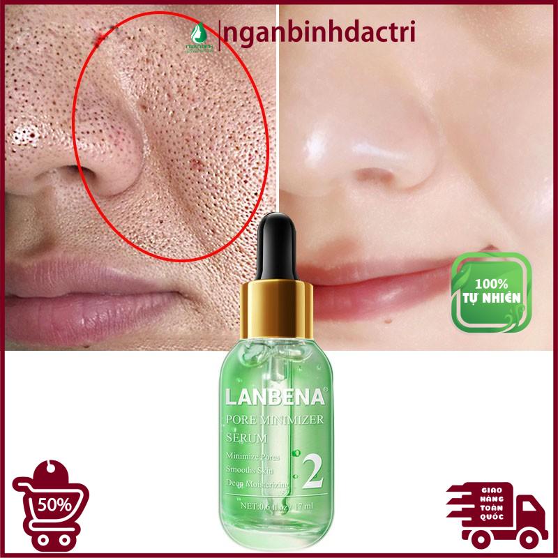 Serum xanh se khít lỗ chân lông loại bỏ mụn đầu đen