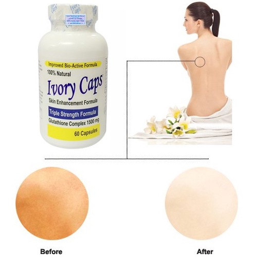 Viên Uống Hỗ Trợ Trắng Da Ivory Caps,Viên Uống Bổ Sung Glutathione Giảm Nám Tàn Nhang AZDOCTOR