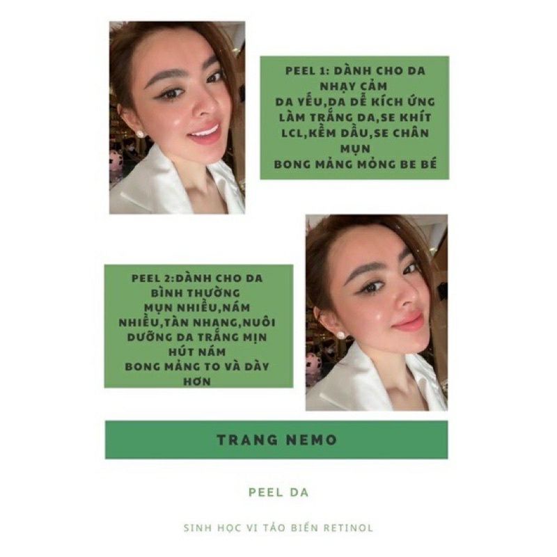 Peel da retinol vi tảo Trang Nemo
