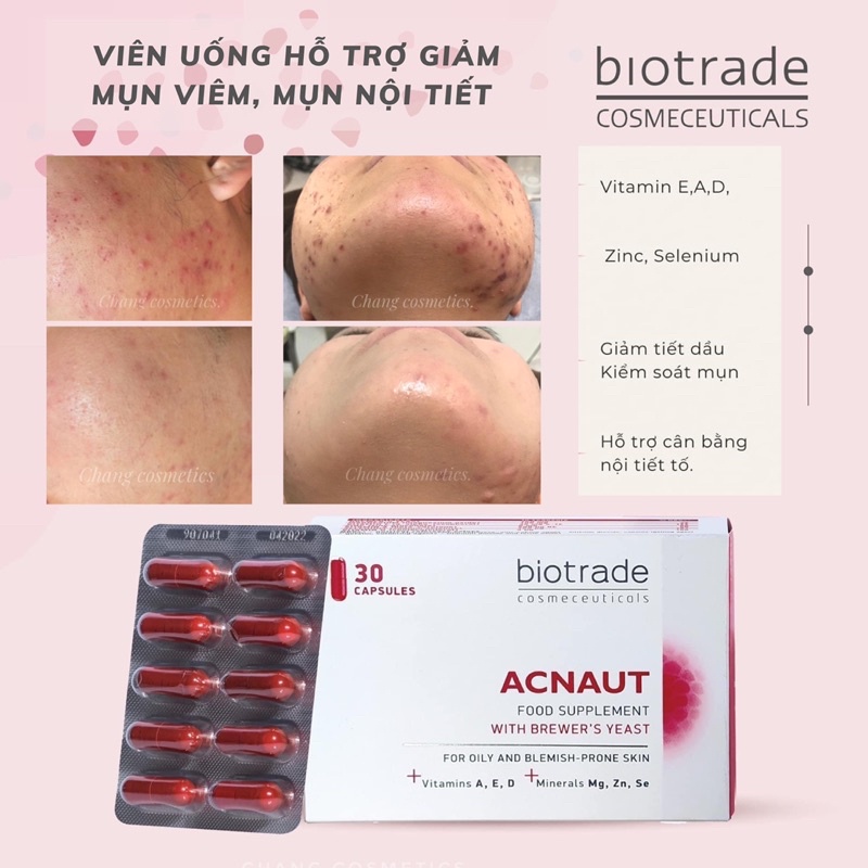 Viên uống giảm mụn Biotrade Acnaut Food Supplement 30 viên, đẹp da, giảm thâm mụn  - Dr. Thu Hà