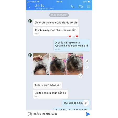 COMBO KÍCH MỌC THẦN TỐC HỖ TRỢ GIẢM RỤNG | BigBuy360 - bigbuy360.vn