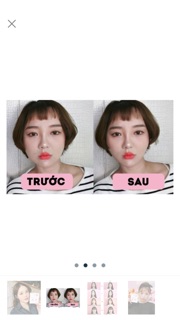Miếng dán thon gọn mặt V line 20 miếng