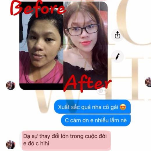 [COLLAGEN ĐẸP DA] Viên uống trắng da Collagen Ace White giúp giảm thâm, mờ nám, dưỡng trắng hồng hào, dưỡng trắng da mặt | BigBuy360 - bigbuy360.vn