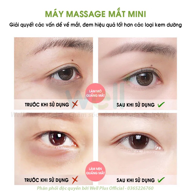 Máy Massage Mắt Mini Cao Cấp, Máy Mát Xa Mắt Làm Giảm Nếp Nhăn Quầng Thâm, Bọng Mắt