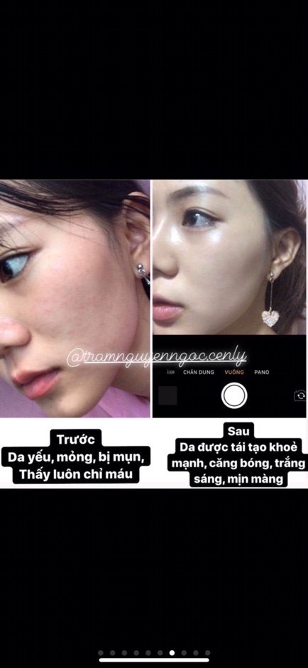 Serum Collagen Tái Tạo Da Amoliskin | BigBuy360 - bigbuy360.vn