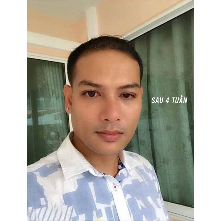 Đinh Hương Nhu xịt mọc tóc | BigBuy360 - bigbuy360.vn