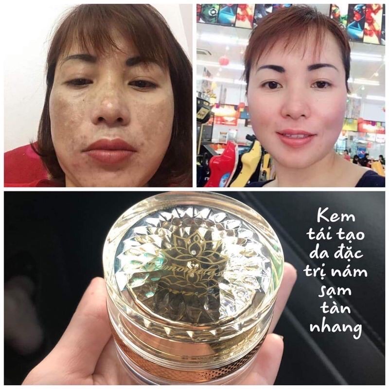 5 HỘP KEM CHAMOMILESKILL