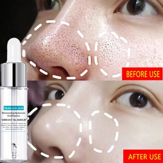 Serum hyaluronic acid Thu Nhỏ Lỗ Chân Lông Làm Săn Chắc Da Mặt Se Khít Lỗ Chân Lông