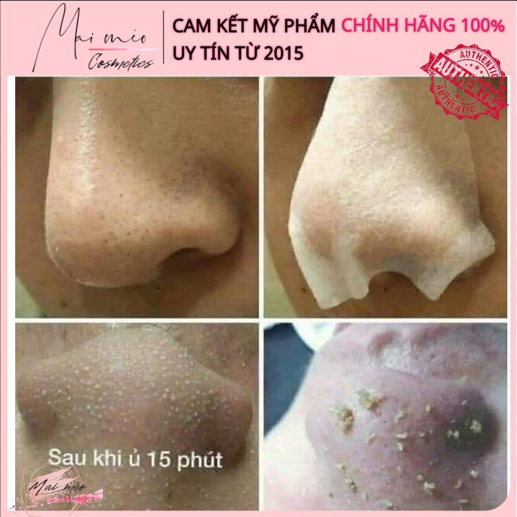 Ủ Mụn Medi-Peel Extra Super9- Mụn Cám Mụn Đầu Đen, Mụn Cám