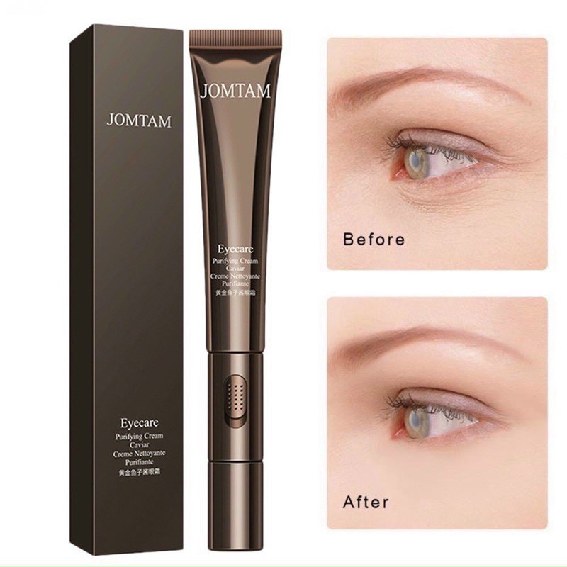 🌸KEM TRỊ QUẦNG THÂM MẮT KÈM CHẾ ĐỘ RUNG MÁT XA TAN BỌNG MẮT, XOÁ NHĂN MẮT JOMTAM | BigBuy360 - bigbuy360.vn