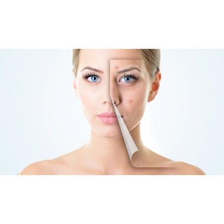 [MỚI] Gel Hút Mụn TitiOne 15g