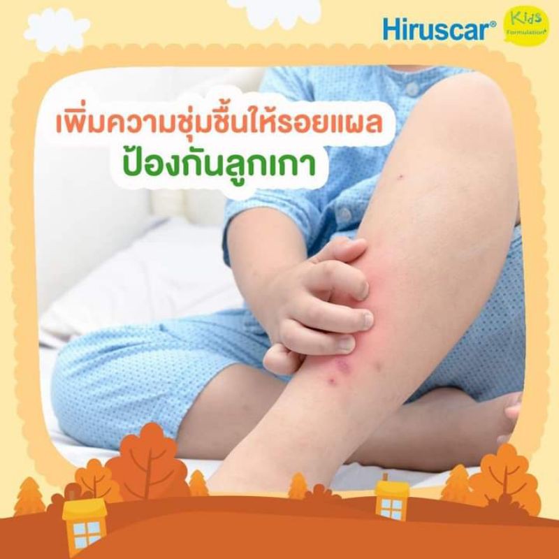 [DATE 27/3/2021] Kem sẹo trẻ em Hirucar Kids