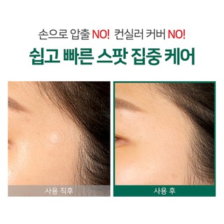 Miếng Dán Mụn "Thần Kỳ' Some By Mi Clear Spot Patch (Set 18 miếng)