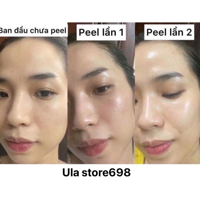 Tinh Chất Peel Da Italy Giảm Mụn Căng Bóng Trẻ Hóa Da Biore Peel.Cl3