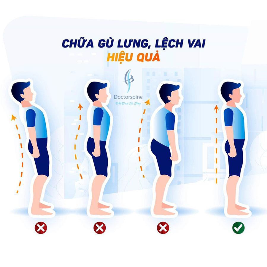 [HÀNG CÔNG TY] Đai chống gù lưng nam nữ Posture corrector - Cải thiện thoái hóa,thoát vị