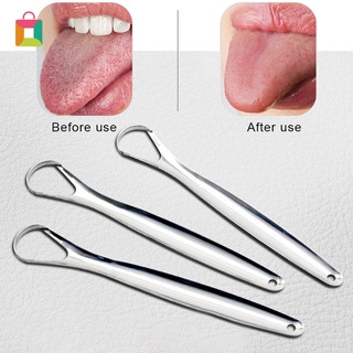 Dụng Cụ Cạo Vệ Sinh Lưỡi Bằng Thép Không Gỉ