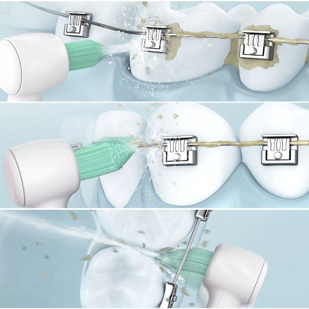 Đầu Tăm Cho Niềng Răng Thay Thế Panasonic WEW0984W251 - Chuyên dùng cho niềng răng