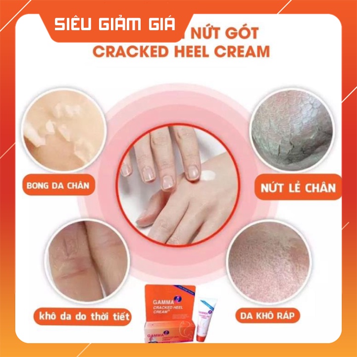 Kem giảm nứt gót chân, khô nứt da Gamma Cracked Heel sản phẩm chuyên dùng cho da khô nứt nẻ cho kết quả cực kỳ tốt. ...