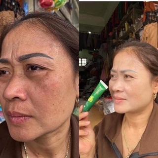 Kem cấy trắng bơ OLIC