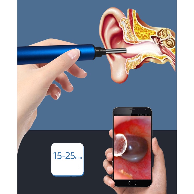 Camera nội soi tai không dây kết nối Wifi phát sáng chăm sóc sức khỏe