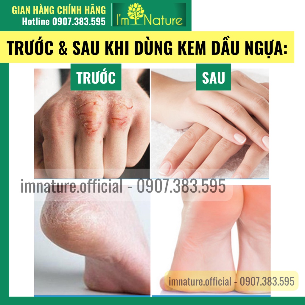 Kem Dầu Ngựa Dưỡng Ẩm Da Tay Da Chân Chống Khô Nẻ 30gr
