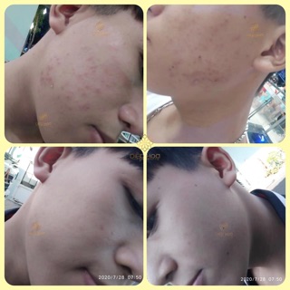 Serum Thảo Mộc OGANA
