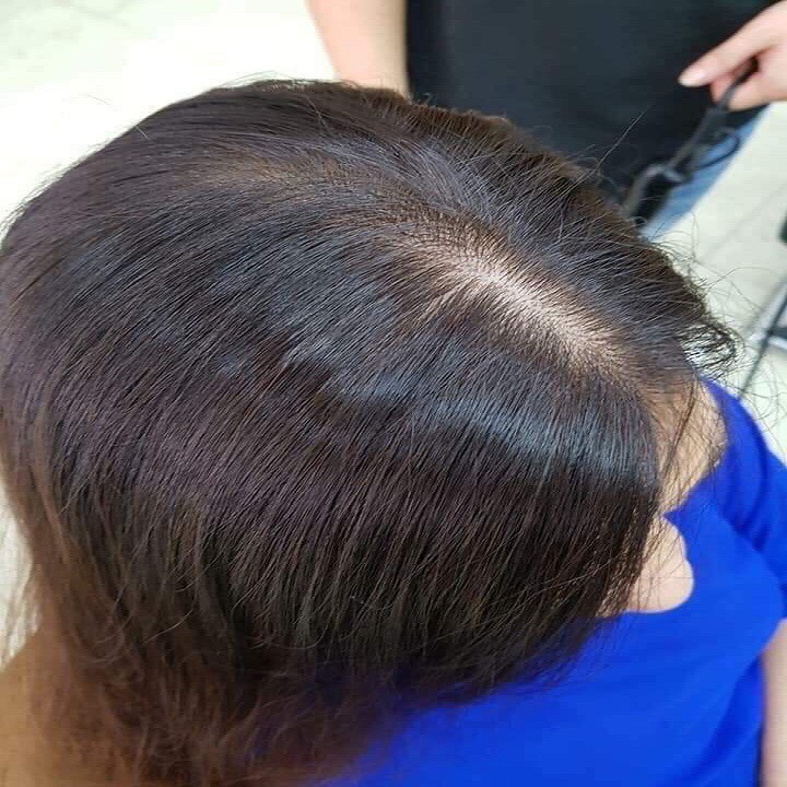 Dầu gội Phủ Bạc Nhân Sâm Sin Hair | BigBuy360 - bigbuy360.vn