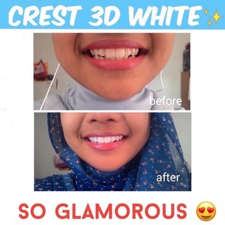MIẾNG DÁN TRẮNG RĂNG CREST 3D WHITE
