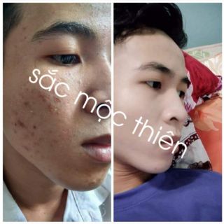 TINH CHẤT TÁI TẠO DA SẮC MỘC THIÊN