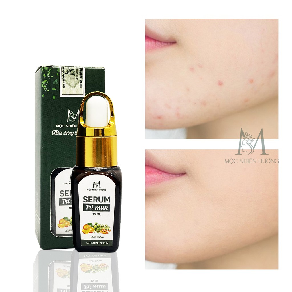 Serum giảm mụn, mờ thâm sẹo rỗ, tái tạo da Mộc Nhiên Hương 10ml dành cho mọi loại da