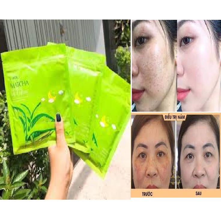 Bịch 15 miếng mặt nạ 𝐓𝐑𝐈̣ nám tàn nhang trà xanh 💖 Giúp da trắng hồng tự nhiên💖