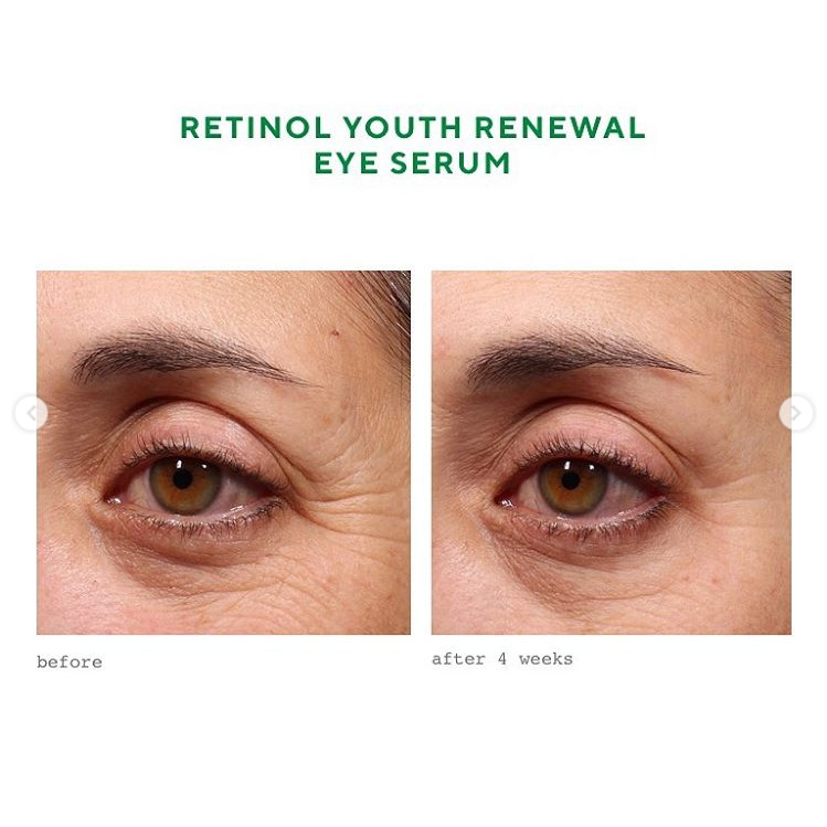 [Fullsize 15ML] Serum giảm thiểu nếp nhăn và bọng mắt Murad Retinol Youth Renewal Eye Serum