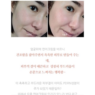 [HÀNG CTY/ TEM VN] Kem phục hồi pdrn cá hồi hồi doclab 138ML