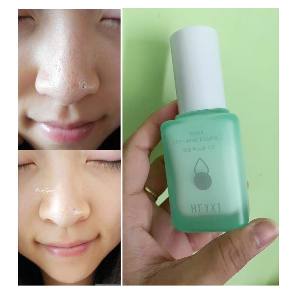 (chính hãng) - Serum HEYXI se khít lỗ chân lông dưỡng ẩm làm mềm da giúp cho da sáng khỏe tự tin | BigBuy360 - bigbuy360.vn