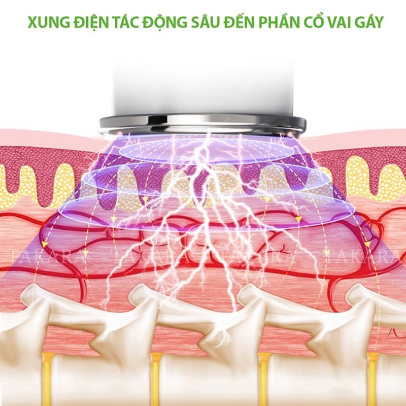 Máy massage cổ vai gáy công nghệ mát xa bằng xung điện giảm đau cổ vai gáy loại mới