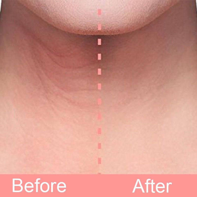 (Hàng Mới Về) Miếng Dán Silicon Trong Suốt Tái Sử Dụng Chống Nếp Nhăn Lão Hóa Da Vùng Cổ | BigBuy360 - bigbuy360.vn