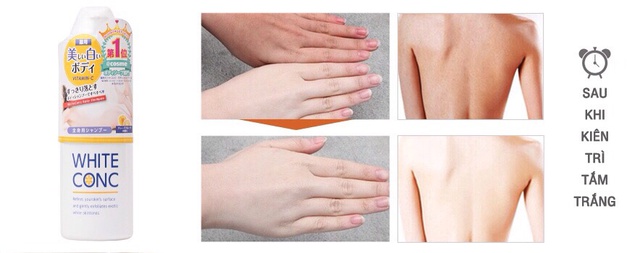 Sữa tắm White Conc Body Vitamin C 360ml (360ml) | BigBuy360 - bigbuy360.vn