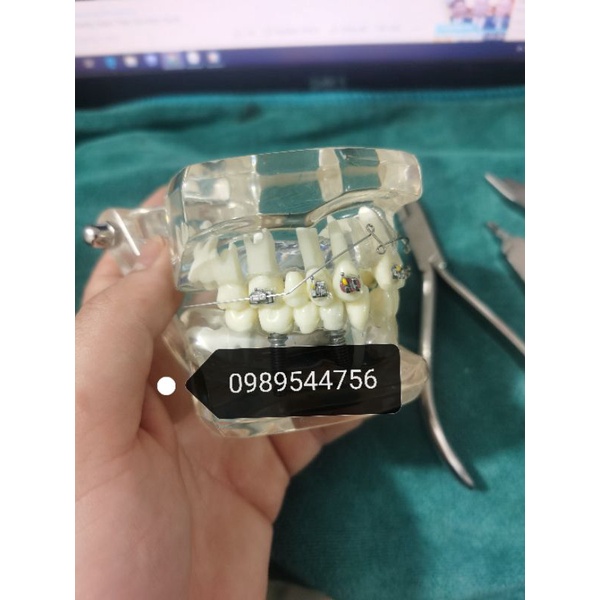 Cung ricketts Bio, cung đánh lún và kéo lui nhóm răng cửa