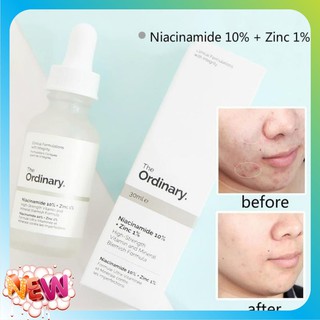 [Shopee Trợ Giá] Serum The Ordinary Niacinamide 10% + Zinc 1% 30ml - Ngừa Mụn Mờ Thâm