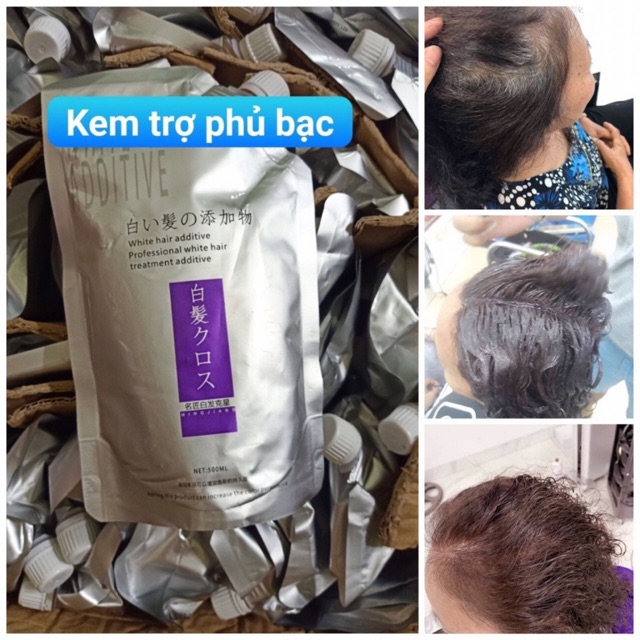 [Phủ bạc 100% ] kem trợ phủ bạc