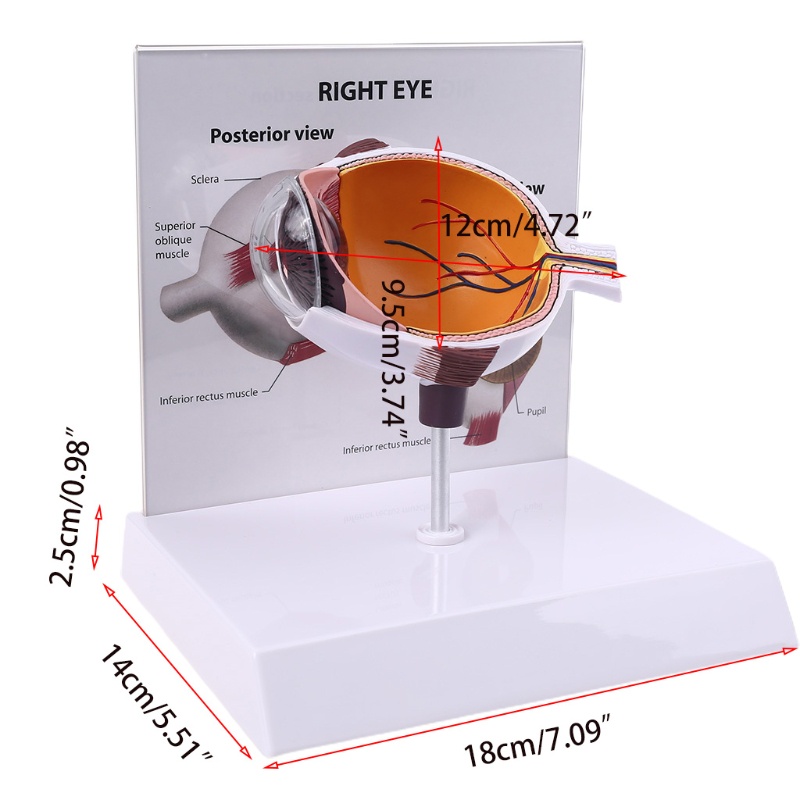 Wer Mô Hình Bóng Mắt Phải Người Cho Trưng Bày Glaucoma Cross Section Anatomical Glaucoma Teac