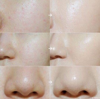 Set 4 món Innisfree