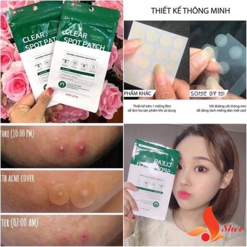 Miếng dán mụn Some By Mi Clear Spot Patch