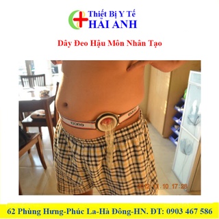 Dây đeo hậu môn nhân tạo