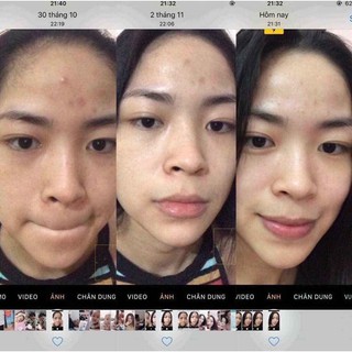 (Combo 3 lọ) Serum biểu bì thực vật V-AURORA