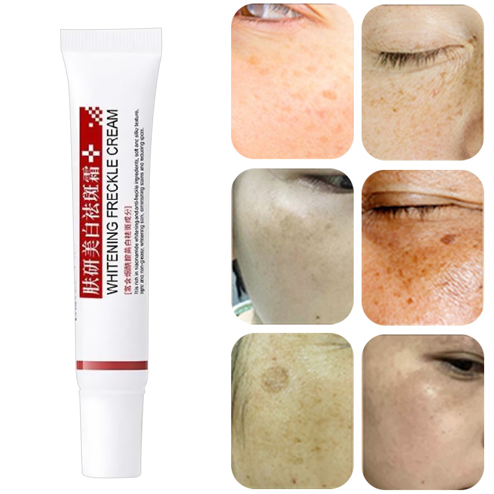 Kem dưỡng trắng da hỗ trợ giảm tàn nhang và đốm đen hiệu quả | BigBuy360 - bigbuy360.vn