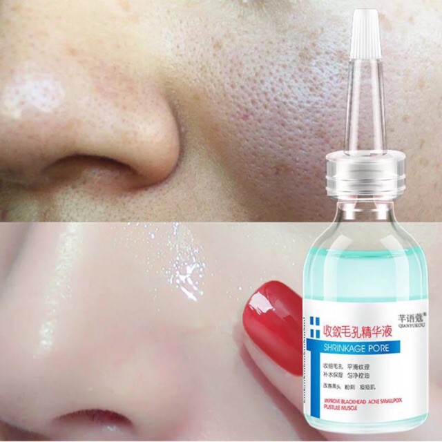 Tinh chất se khít lỗ chân lông,Serum Dưỡng Ẩm Se Khít Lỗ Chân Lông Làm Trắng Sáng Da