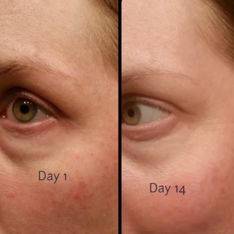 Kem dưỡng mắt Estée Lauder Re-Nutriv Ultimate Diamond Transformative Energy Eye Creme